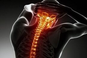 Osteochondrozės skausmas