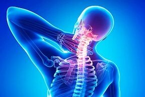 nugaros skausmas kaip osteochondrozės simptomas