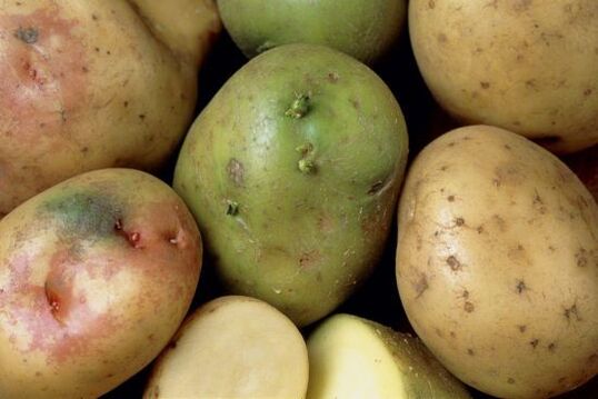 žalios bulvės nuo pirštų sąnarių skausmo