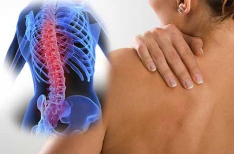 Krūtinės ląstos stuburo osteochondrozės paūmėjimo metu atsiranda dorsago skausmas