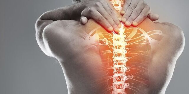 Gimdos kaklelio osteochondrozės gimdos kaklelio terapijos medicinos galimybės
