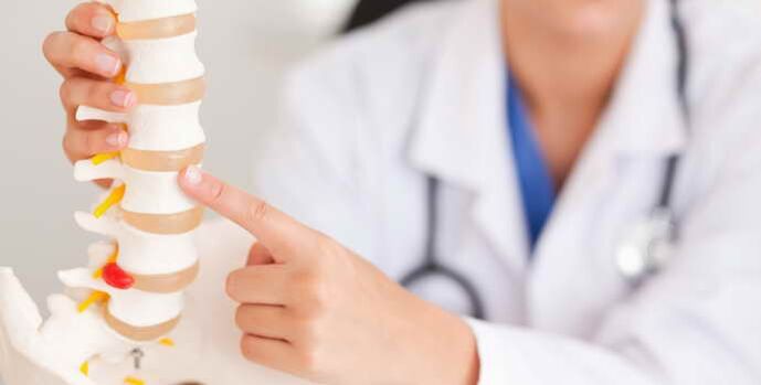 Osteochondrozė yra stuburo liga