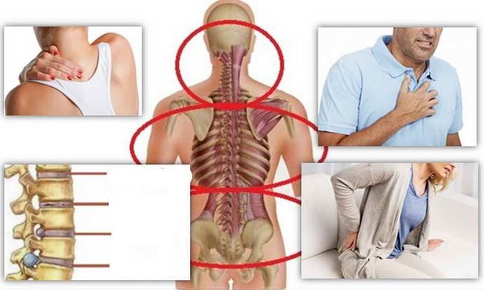 Osteochondrozės ligos vietos