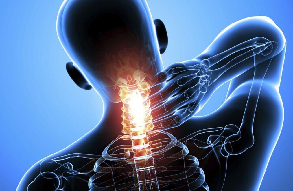 Gimdos kaklelio stuburo osteochondrozė